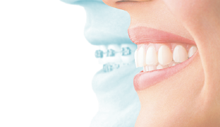 目立たない矯正治療なら浜松市のきた矯正歯科クリニックへ 浜松市でインビザラインならきた矯正歯科クリニックへ 目立たない矯正治療なら浜松市のきた矯正歯科クリニックへ 浜松市でインビザラインならきた矯正歯科クリニックへ